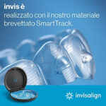 invisalign2